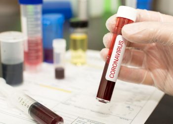 Αρνητικά τα τεστ COVID-19 στον Δήμο Φαρκαδόνας