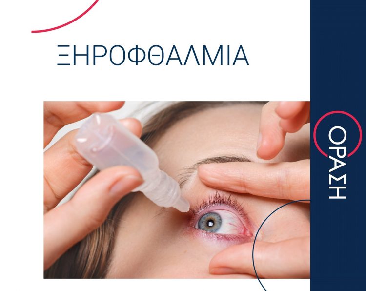 Ξηροφθαλμία: Για αποτελεσματική λύση μόνο στην ΟΡΑΣΗ