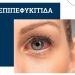ΟΡΑΣΗ | Επιπεφυκίτιδα: Συμπτώματα και αντιμετώπιση