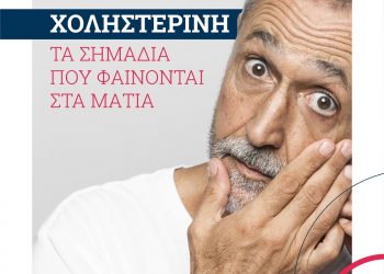 Ανεβασμένη χοληστερίνη: Τα σημάδια που φαίνονται στα μάτια
