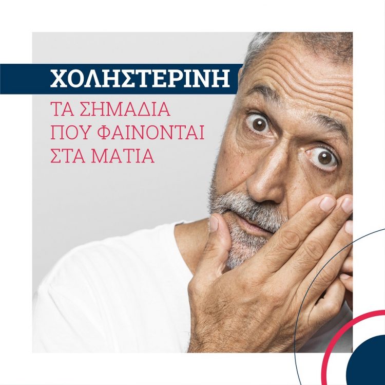Ανεβασμένη χοληστερίνη: Τα σημάδια που φαίνονται στα μάτια