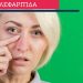 Βλεφαρίτιδα: Τι είναι και πώς αντιμετωπίζεται