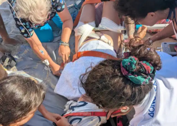 Σοκαριστικό περιστατικό: Ο αέρας σήκωσε ομπρέλα και την κάρφωσε στο πόδι κοπέλας που ζει και εργάζεται στη Λάρισα – Ανατριχιαστικές εικόνες